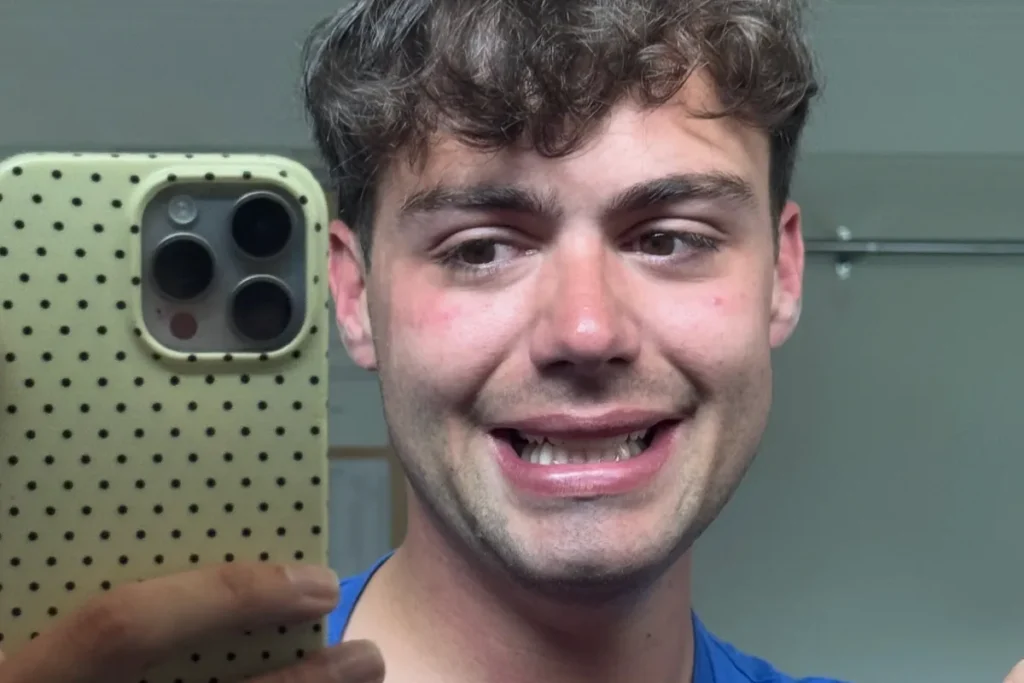 Heartstopper Star Bradley Riches Burgled, Automobile and Espresso Truck Stolen